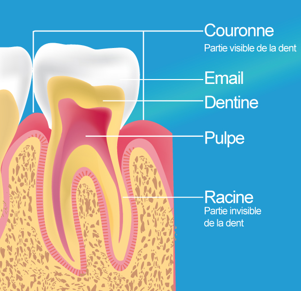 schéma dent traitement endodontique