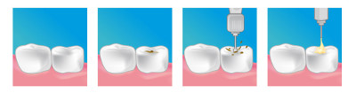 soins dentaire orthodontiste saint mande
